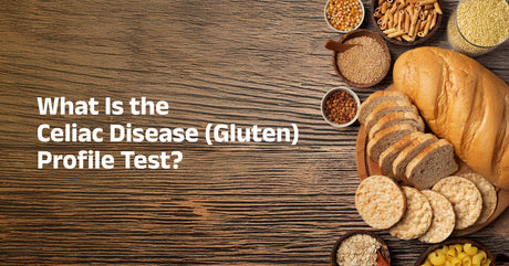 Celiac Disease (Gluten) Profile Test: Symptoms, Accuracy, and At-Home Blood Testing
