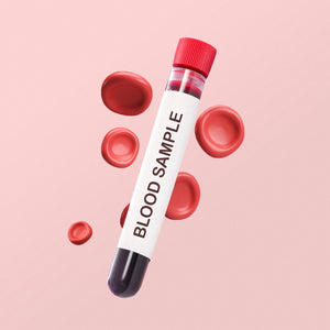 Bleeding & Clotting (Coagulation) Profile
