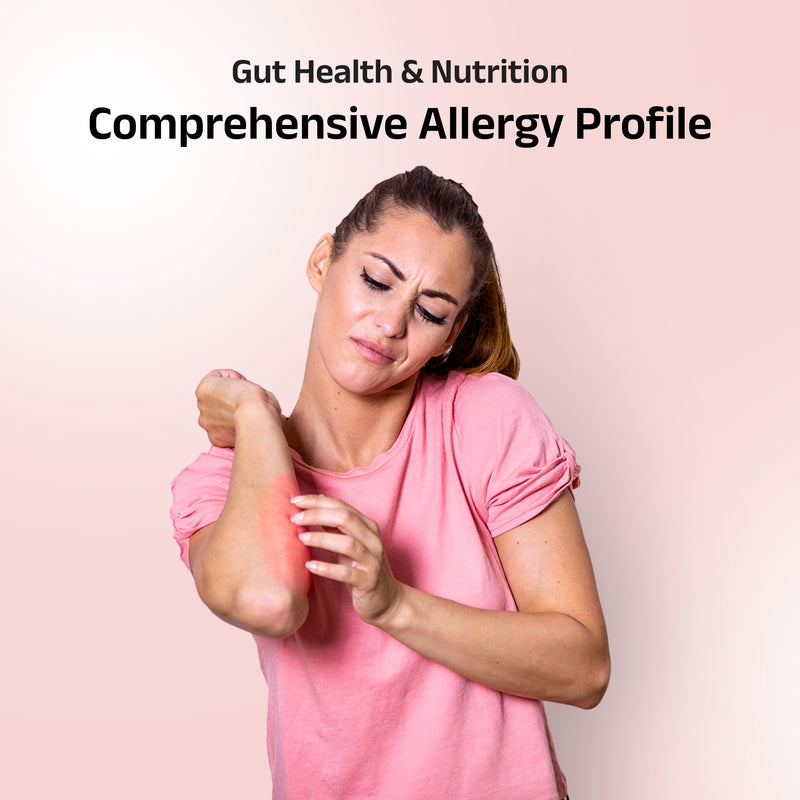 Full Allergy Panel (300+ allergens)