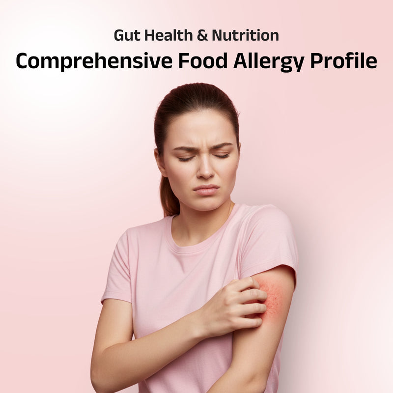 Food Allergy Panel (44 parameters)