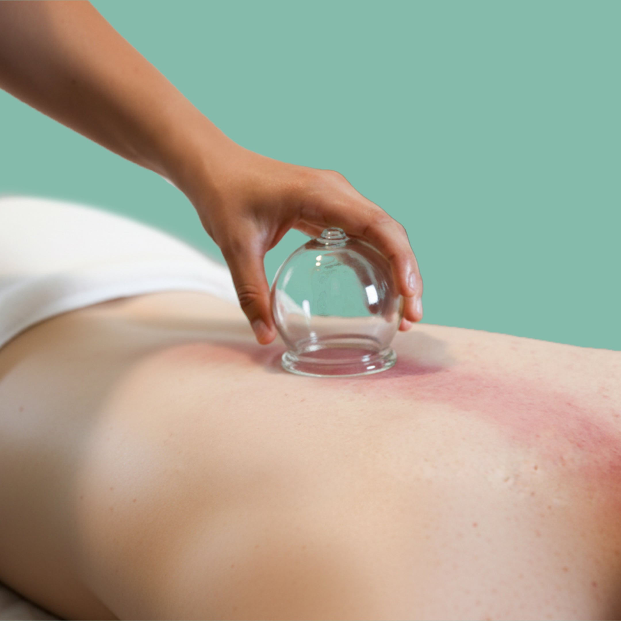 Cupping Session