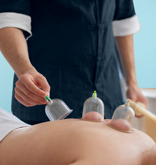 Wet Cupping Session (Hijama)