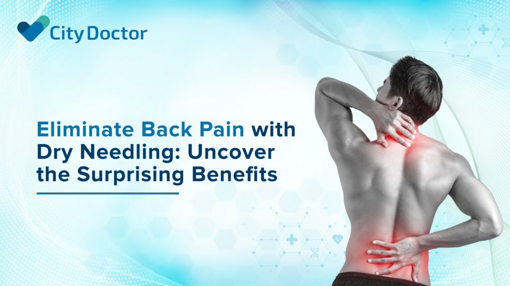 Dry Needling for Back Pain