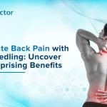 Dry Needling for Back Pain