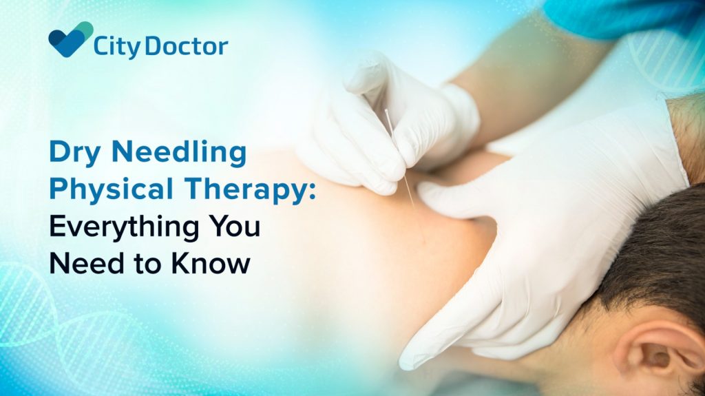 : Dry Needling Therapy Guide